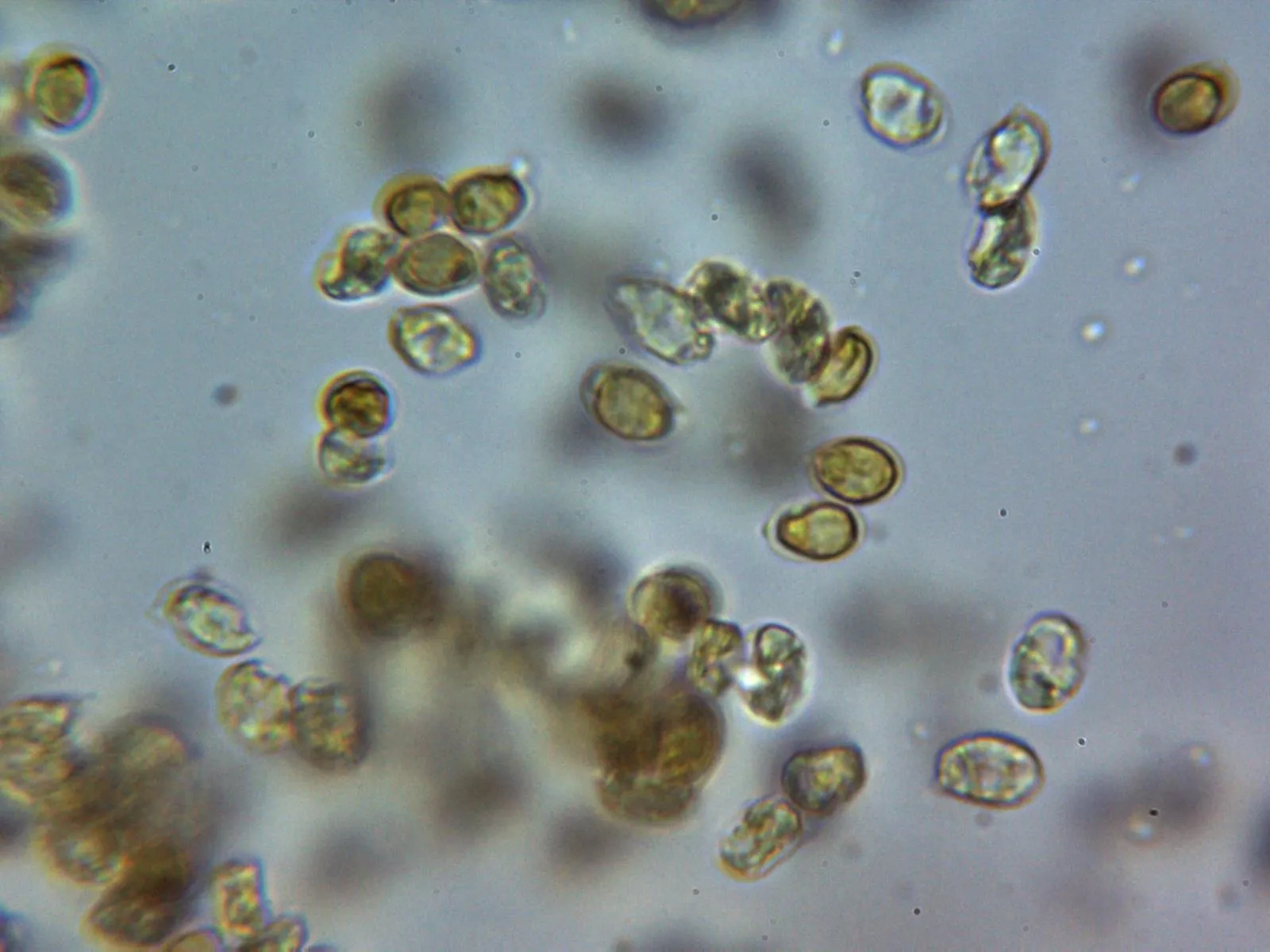 Microscopía de Radulomyces molaris - 10 - Esporada Melzer 1